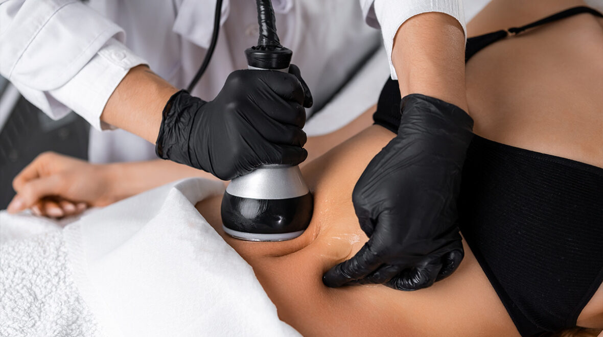 Liposukcja kawitacyjna: Czy to naprawdę działa? Fakty i mity