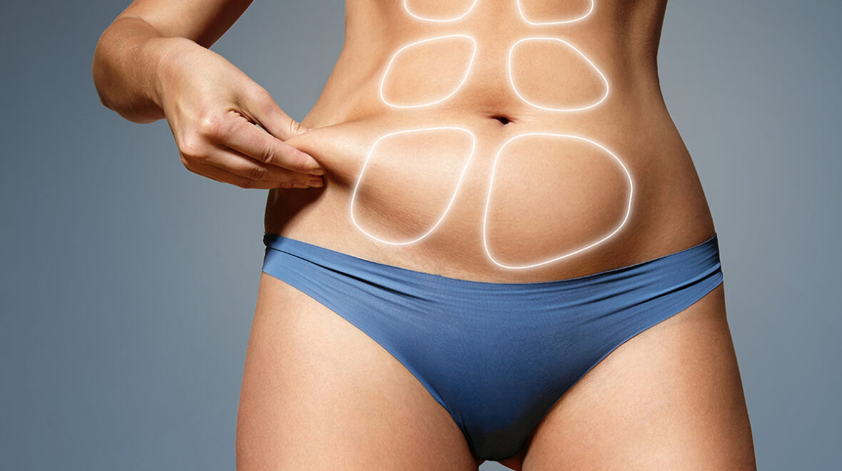 Lipolaser – dla kogo jest ten zabieg i jakich efektów można się spodziewać?