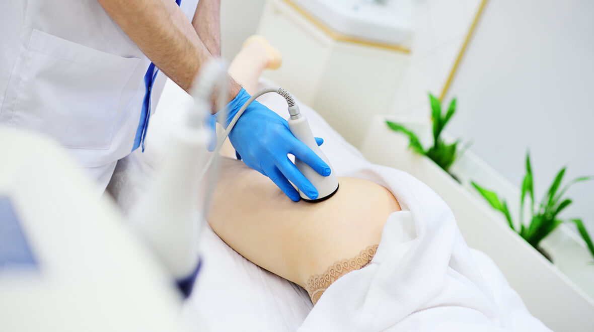 Liposukcja kawitacyjna – nowoczesne modelowanie sylwetki w Opolu