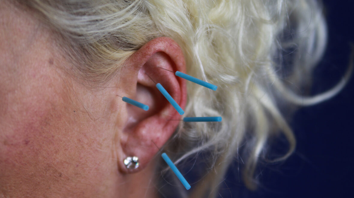 Aurikuloterapia – fakty i mity. Co naprawdę działa?